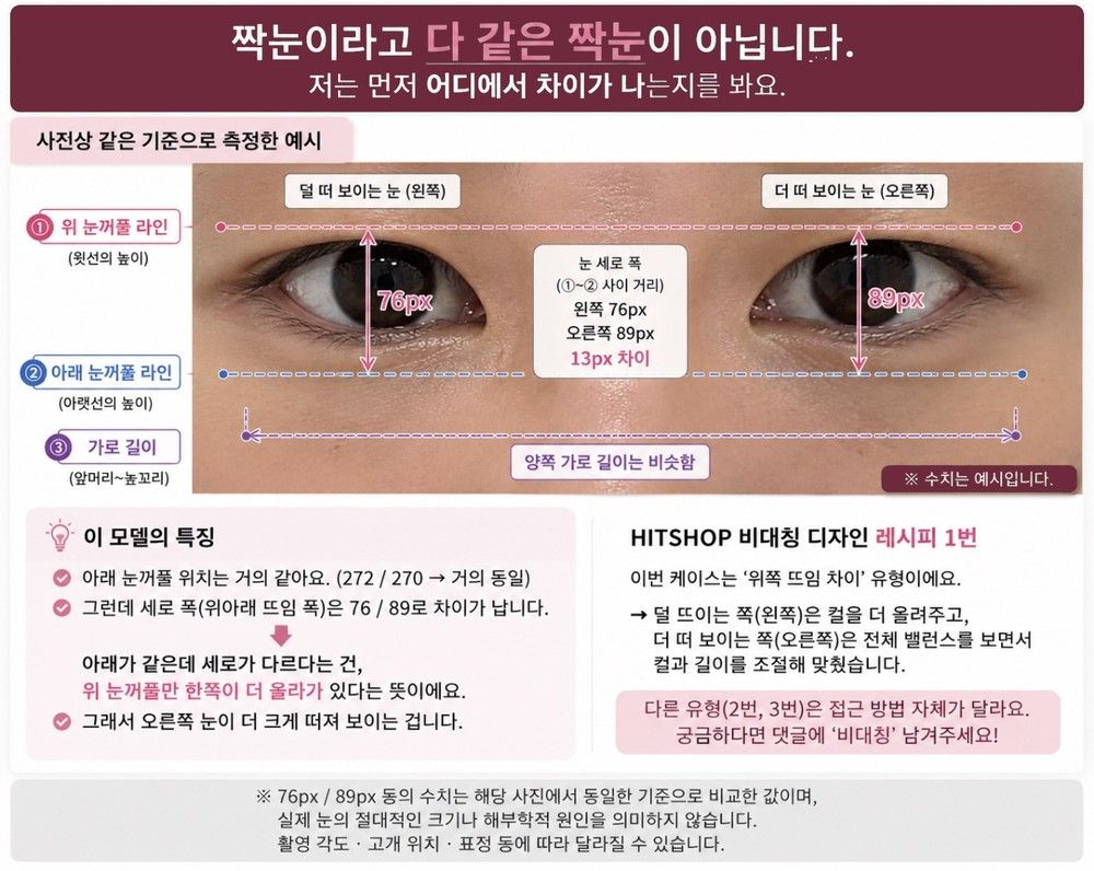HITSHOP 비대칭 눈매 분석 자료 - 위 눈꺼풀 라인과 아래 눈꺼풀 라인, 눈 세로 폭을 같은 기준으로 측정해 짝눈의 원인을 찾는 방법
