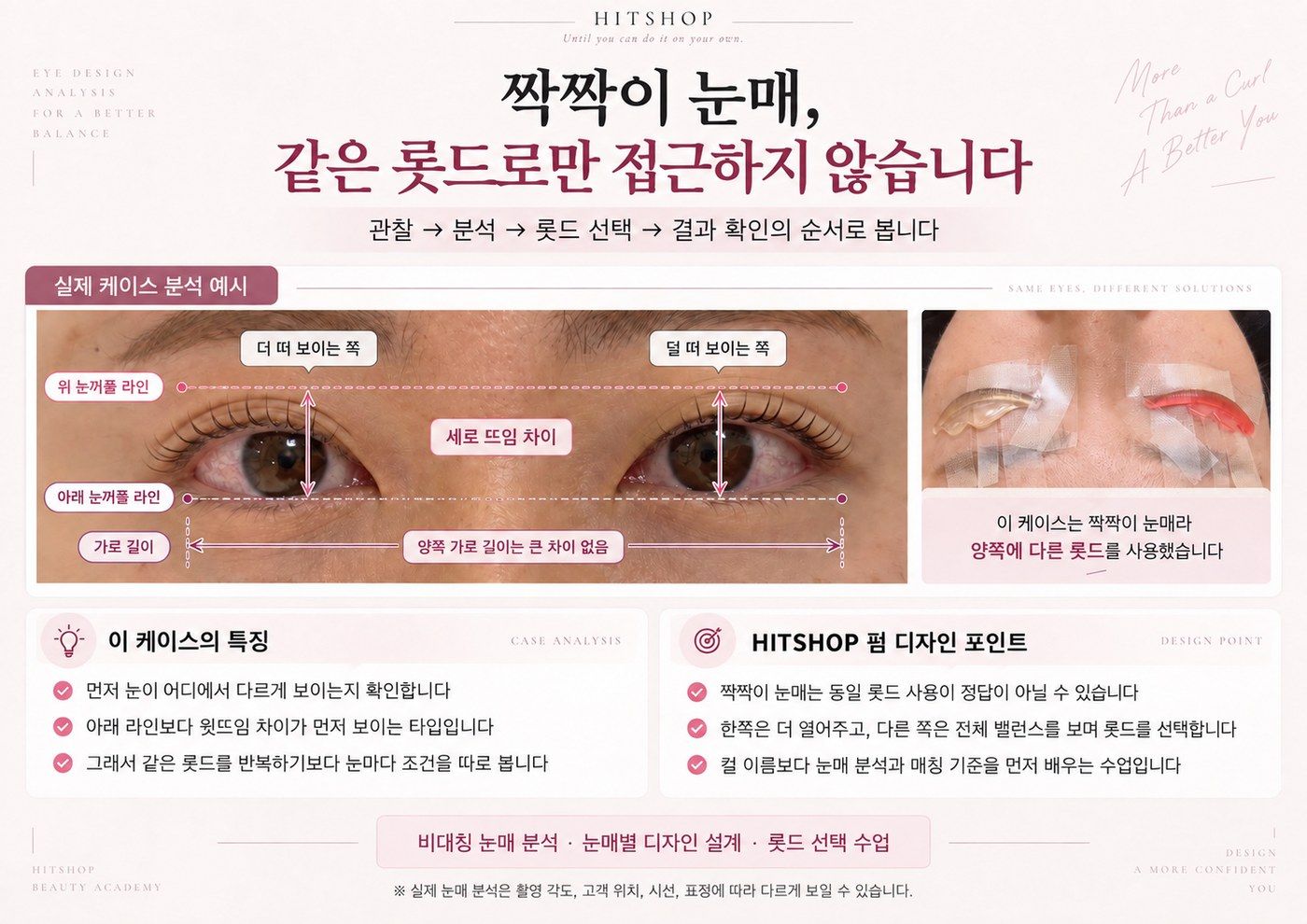 짝짝이 눈매 케이스 분석 자료 - 위아래 눈꺼풀 라인과 세로 뜨임 차이를 측정하고 양쪽에 다른 롯드를 선택한 실제 수업 예시