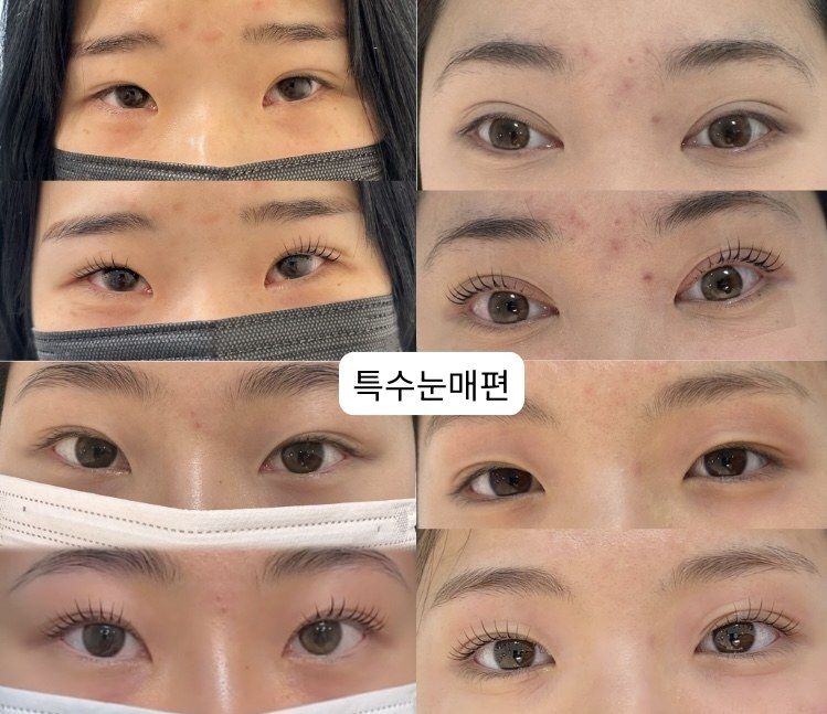 특수 눈매 케이스별 속눈썹펌 전후 비교 자료