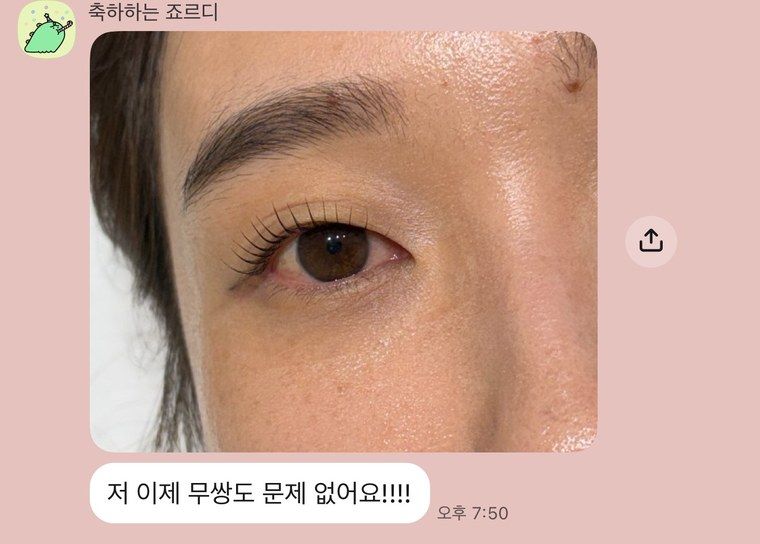무쌍 눈매 시술 결과 사진과 함께 보내온 수강생 후기 메시지